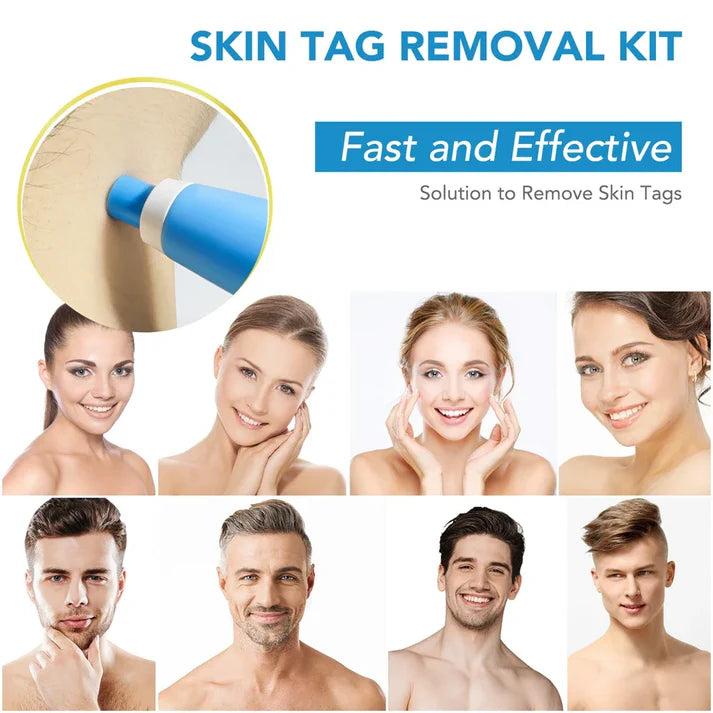 2-in-1 Skin Tag & Mole Remover Kit – Automatic Micro Removal Device for Face & Body