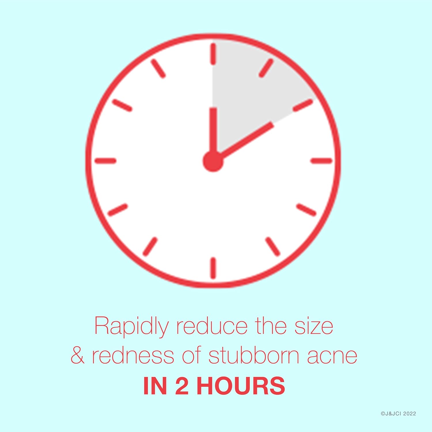 Neutrogena Rapid Clear Stubborn Acne Spot Treatment Gel with Maximum Strength 10% Benzoyl Peroxide Acne Treatment Medication, Pimple Cream for Acne Prone Skin Care, 1 oz