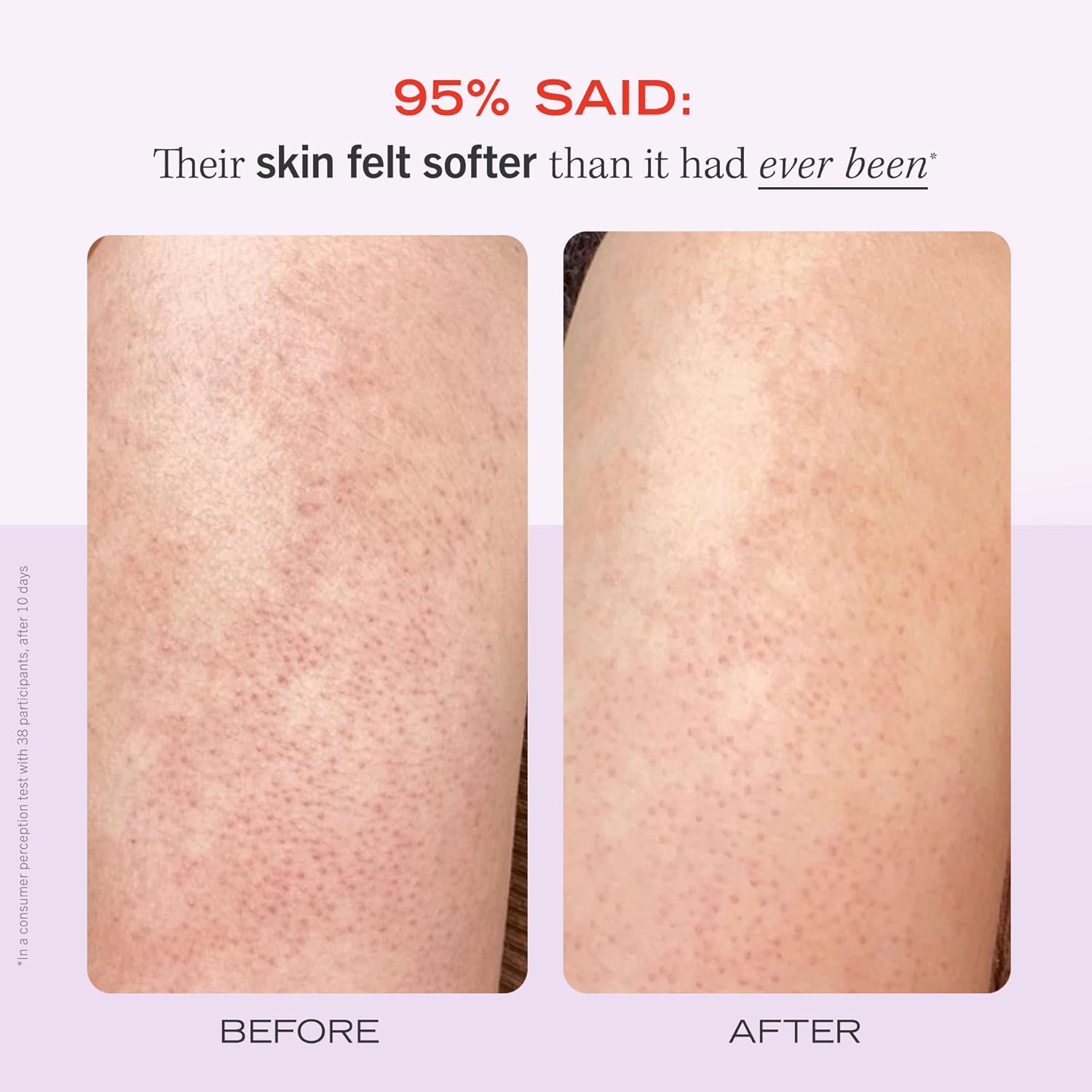 First Aid Beauty - KP Bump Eraser Body Scrub with 10% AHA, Keratosis Pilaris Exfoliator with Glycolic and Lactic acids, Helps Reduce Chicken Skin Bumps, Safe for Sensitive Skin, Strawberry Scent, 8 oz