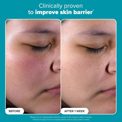 Paula's Choice SKIN PERFECTING 2% BHA Liquid Salicylic Acid Exfoliant-Facial Exfoliant for Blackheads, Enlarged Pores, Wrinkles & Fine Lines