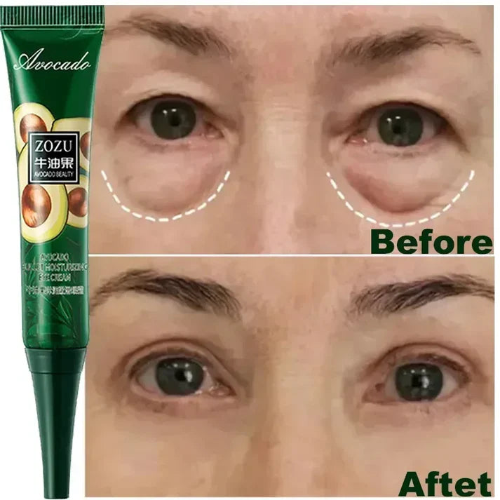 Instant Wrinkle-Removal Eye Cream – Anti-Aging, Dark Circles & Puffiness Treatment